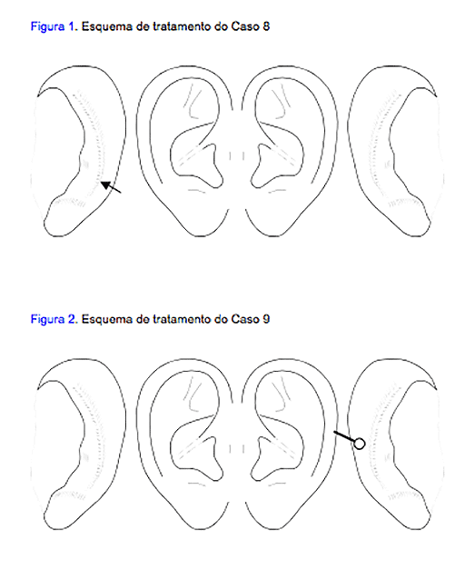 schema